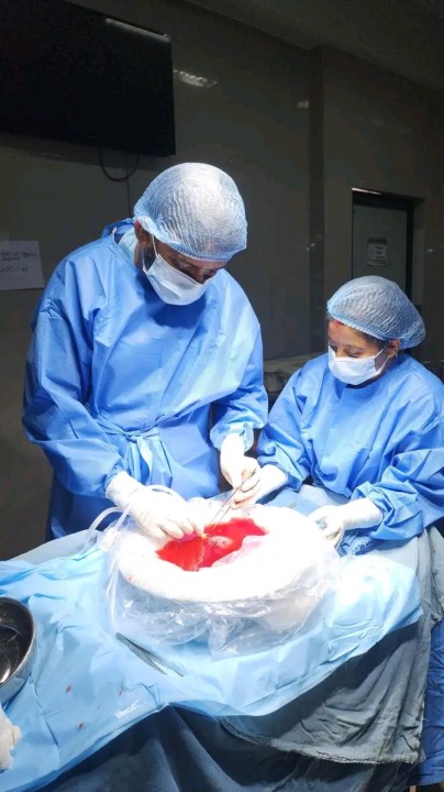 Liver transplantt.jpg